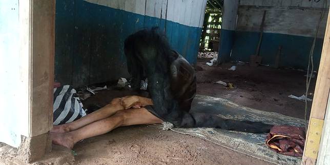 Sukiyah, 27 Tahun Mengurung Diri Sampai Rambut Jadi Sarang Tikus