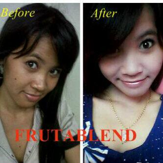 MLM kecantikan before afternya wow - mastah sotosop dan potpgraphy - benci MLM masuk