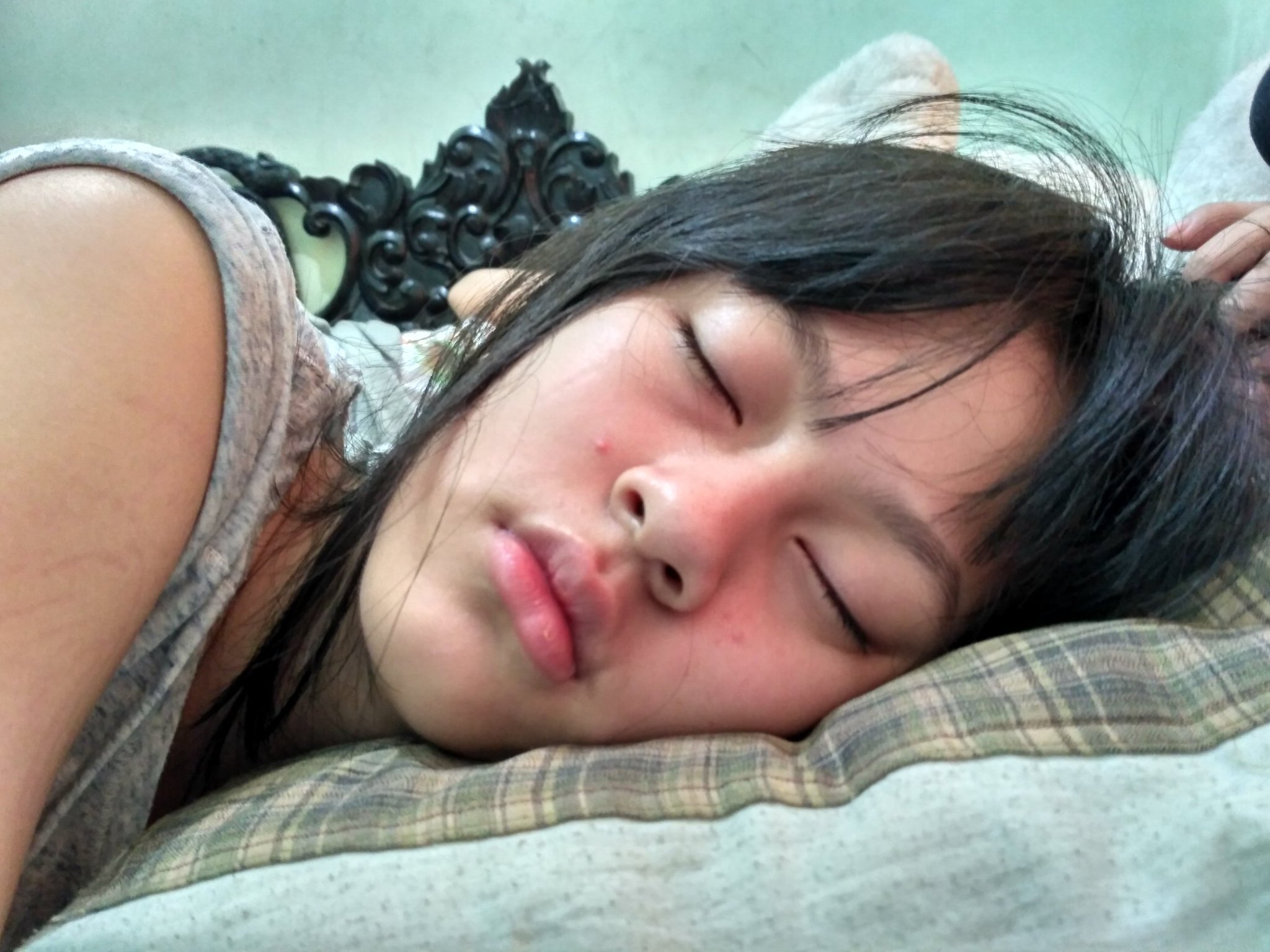 kenapa-jerawat-terus-muncul-walau-rutin-menjaga-makanan-dan-kebersihan-wajah