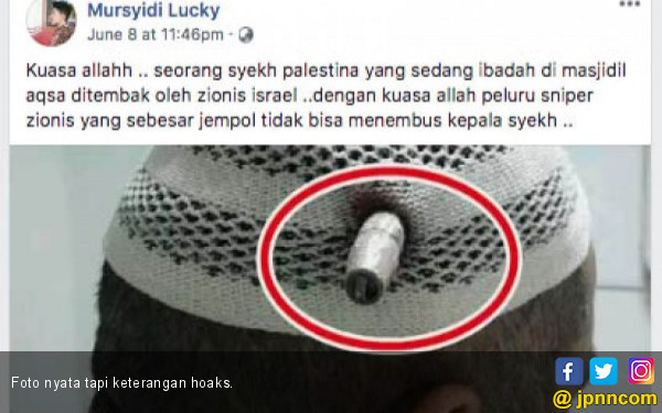 Ternyata, Peluru Menancap di Kepala Pria Ini Bukan Hoaks