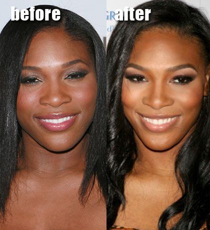 BEFORE AFTER ...PLASTIC SURGERY VS MAKE UP... WHICH ONE YOU CHOOSE?