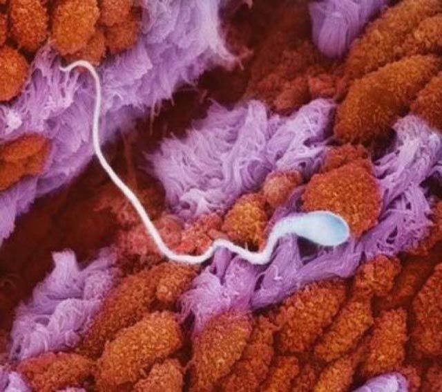 karya-lennart-nilsson-foto2-keren-perkembangan-sperma-menjadi-janin-dalam-rahim