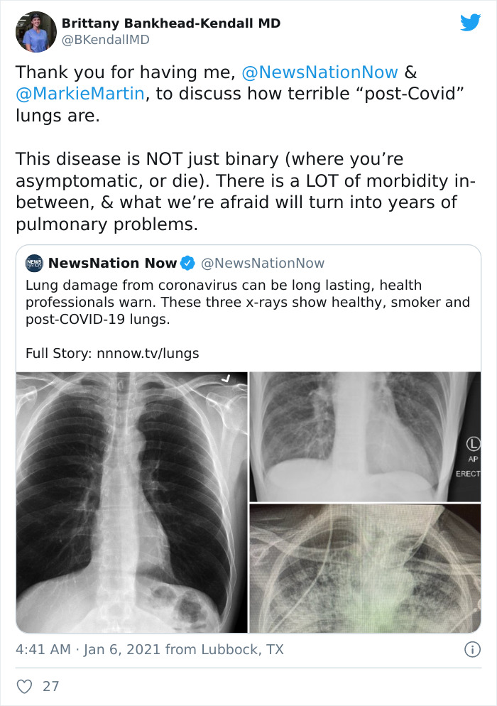 beginilah-perbandingan-paru-paru-orang-sehat-perokok-dan-penderita-covid-19