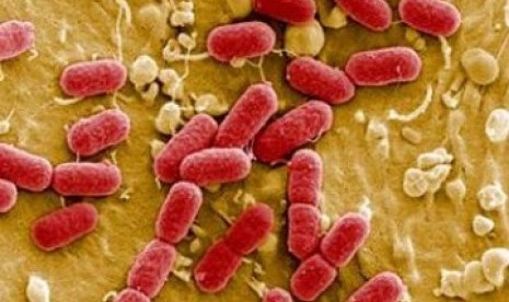 Bahaya E coli Bagi Kesehatan