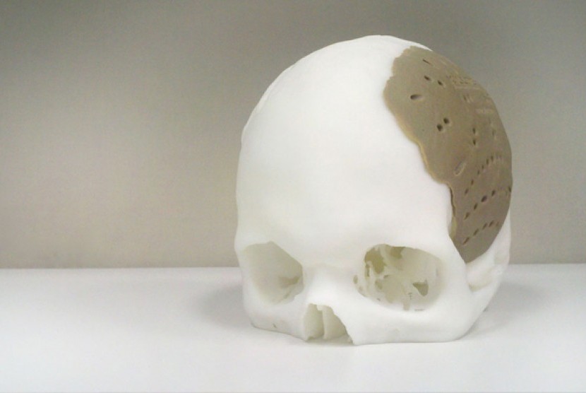 peneliti-berhasil-uji-tulang-buatan-dicetak-printer-3d