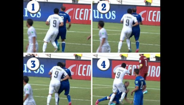 Gigitan Suarez Bernilai Rp 12 Juta