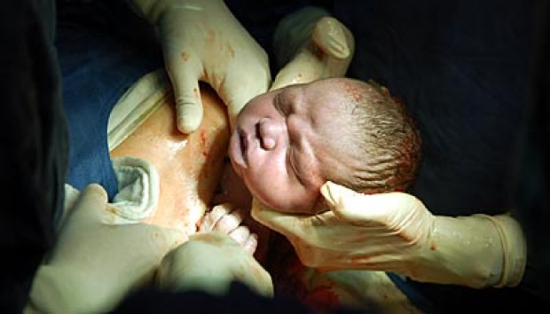 Tunda Potong Tali Pusat Sehatkan Bayi?