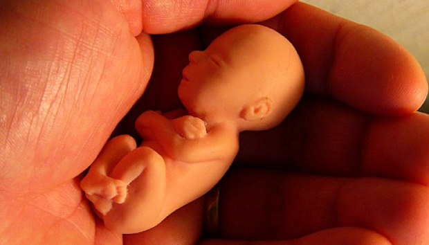 Kehamilan Bocah 11 Tahun Memicu Perdebatan Aborsi di Cili