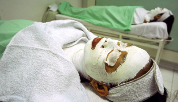 Industri Estetika Indonesia Berkembang Pesat