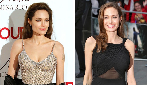 Banyak Wanita Ikuti Langkah Angelina Jolie