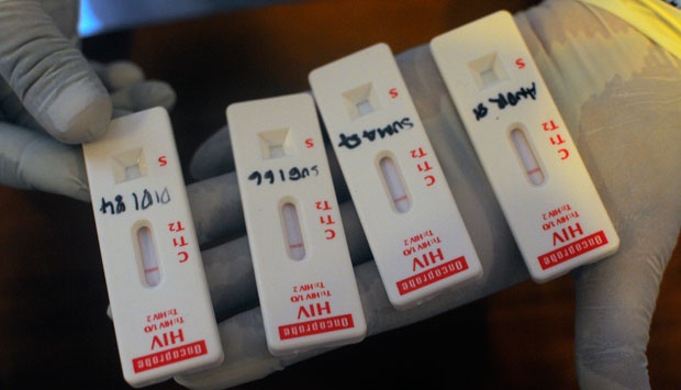 &#91;ngeri&#93; Penderita HIV/AIDS di Jakarta Membeludak