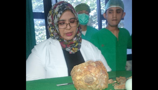 batu-2-kilogram-bersarang-di-kemih-odih