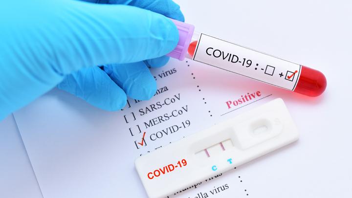 rapid-test-corona-pakar-rekomendasikan-tes-berbasis-antigen