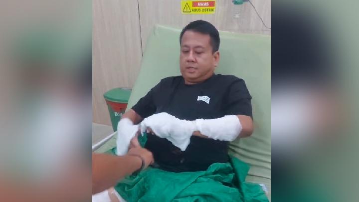 Aktivis di Bangka Belitung Diduga Disiram Air Keras