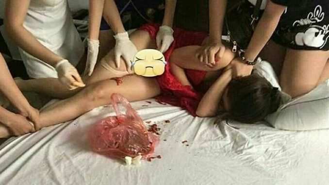 Ngeri! Ketahuan Main Serong, Kemaluan Wanita Ini Disiram Cabai Oleh Istri Selingkuhan