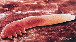 Waspadai Demodex, Parasit Perusak Kulit (Must see)