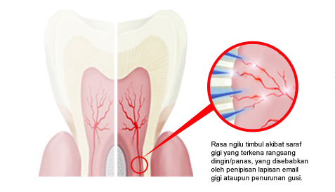 Punya Masalah Gigi Sensitif? Hewan Laut Ini Solusinya!