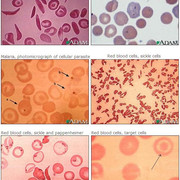 Membaca hasil lab sendiri (ノ◕ヮ◕)ノ*:・゚✧