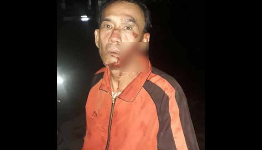kepala-ditusuk-pengemudi-grab-dibegal-pelanggannya-di-medan-deli