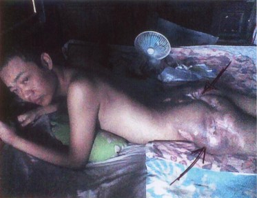 1 lagi nih korban tusbol aku :cool