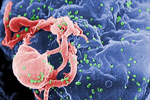 "Asal Usul Penyakit AIDS"