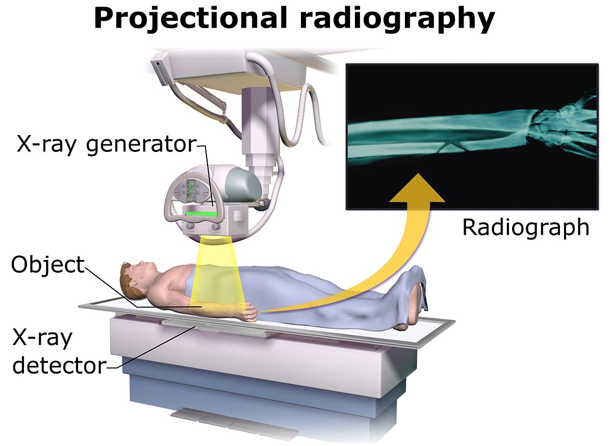 X-Ray dan Cara kerjanya 