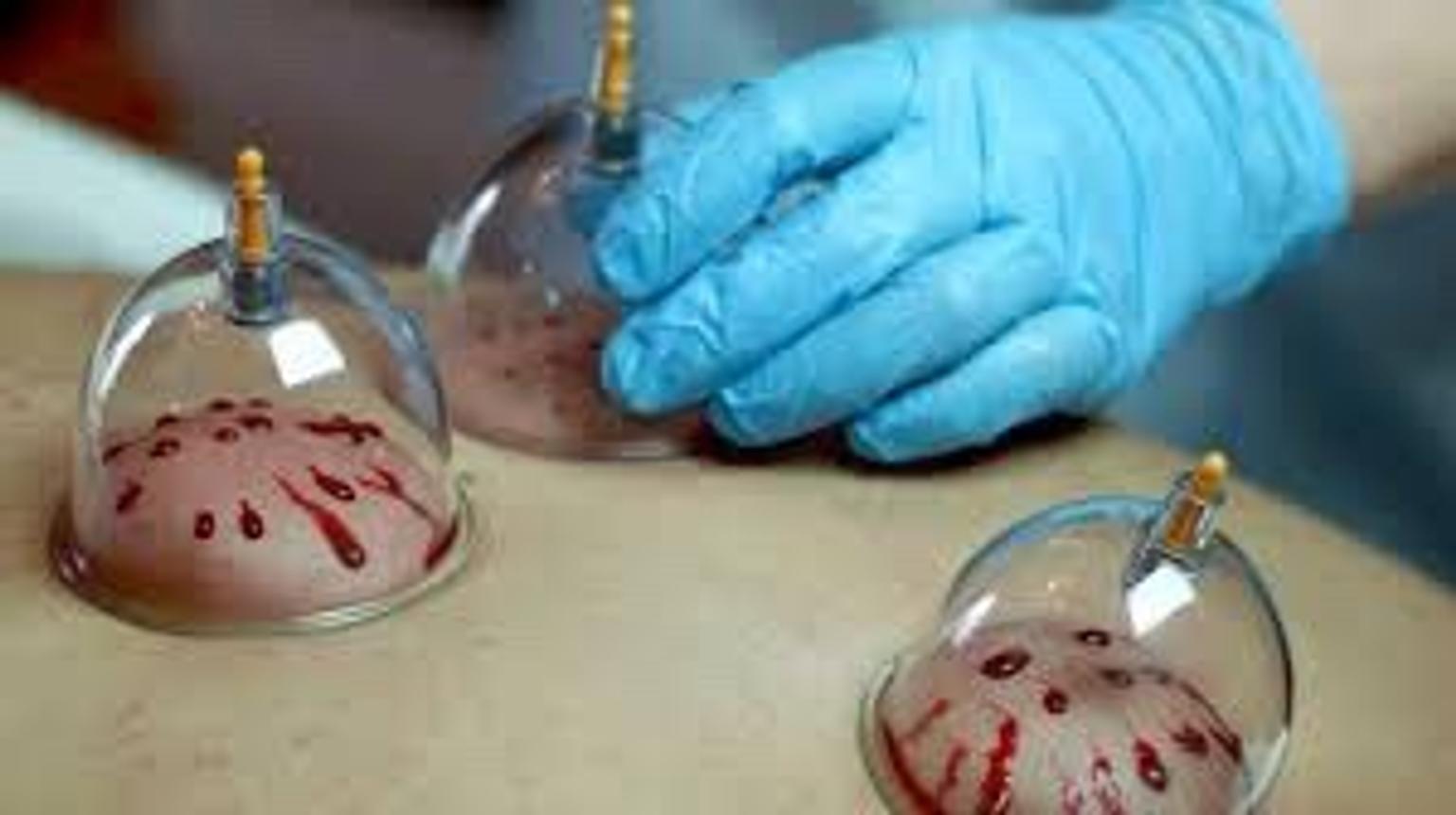 6 Obat &amp; Pengobatan Herbal Khas Korea Selatan Yang Ada Sejak Zaman Dahulu