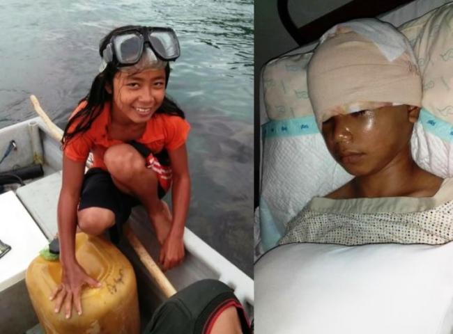 Tuhan Menjadikan Ayu Sebagai Perantara Pada Yang Lainnya Agar Bisa Lebih Bersyukur