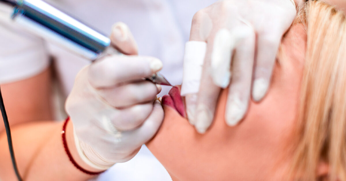 Mengenal Sulam Bibir, Mulai dari Jenis Hingga Efek Sampingnya