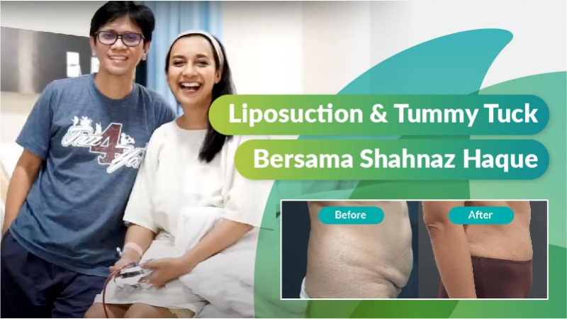 Liposuction &amp; Tummy Tuck, Berdasarkan Pengalaman Shahnaz Haque