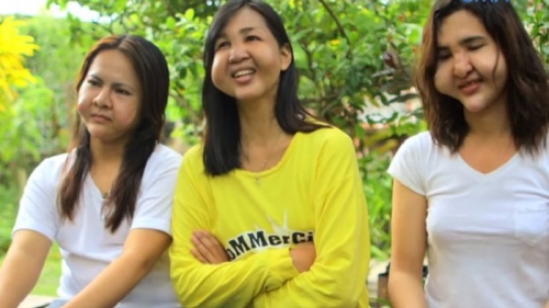 suntikkan-petroleum-jelly-3-wanita-ini-jadi-cantik-6-bulan-kemudian-mengerikan