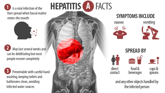 Begini Cara agar Tak Tertular Hepatitis A