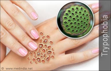 Cara ampuh menghilangkan Trypophobia