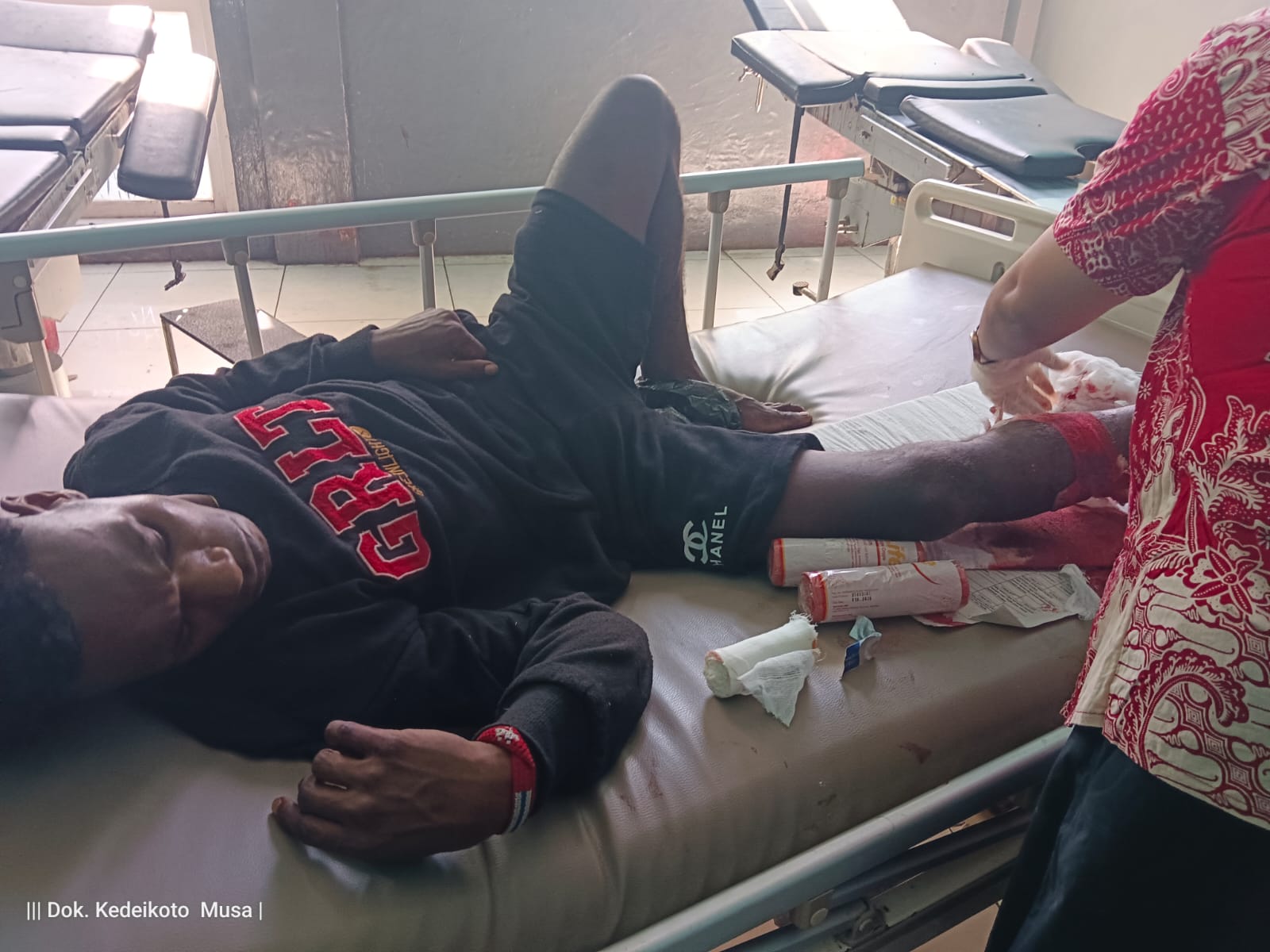 Kericuhan di Pasar Karang Tumaritis Nabire, Seorang Warga Meninggal dan Dua Tertembak