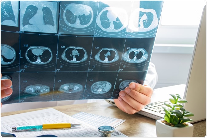 Malam Ini Sampai Indonesia, 68 ABK Diamond Princess Negatif Corona? Tes CT SCAN!