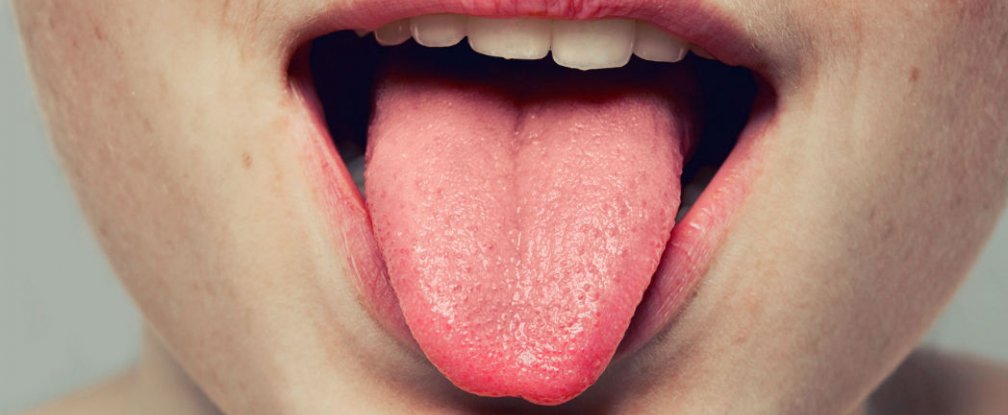 PENGECAP RASA TERBARU DI LIDAH UNTUK ‘DETEKSI’ OBESITAS?