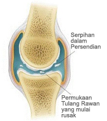 Kebiasan Sepele Yang Ternyata Berbahaya!