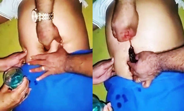 Gimana jadinya kalau seeekor tikus masuk ke pusar perut kita?